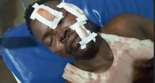 Kalemie : un braquage violent sème la panique au marché Katanga&nbsp;Kivu